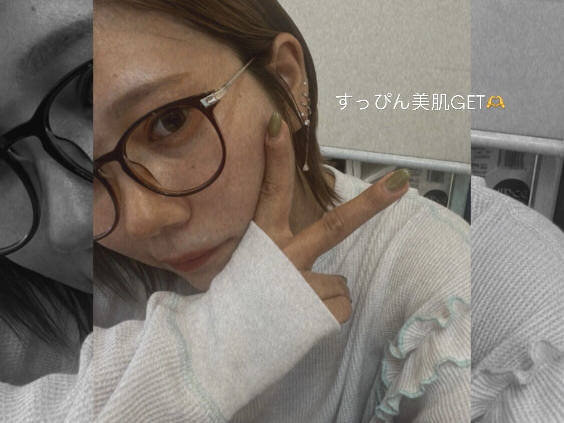 私のスキンケア事情①